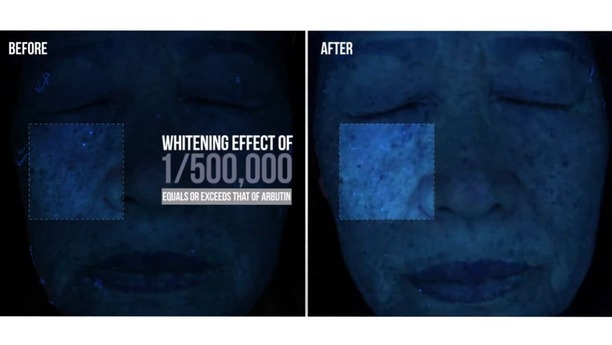 ½æ³×ÀÏ À̹ÌÁö